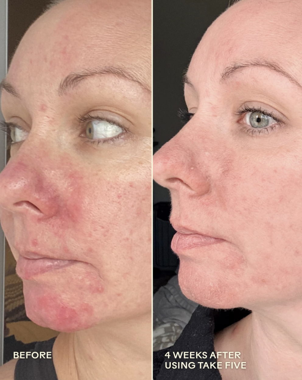 Take Five™ Hypochlorous Acid Balancing Body + Face Spray